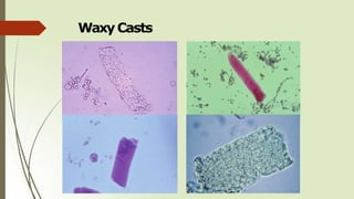 WaxyCasts
 
