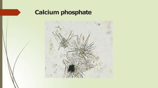 Calcium phosphate
 