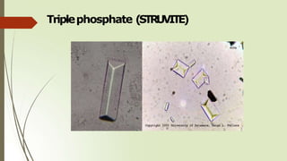 Triplephosphate (STRUVITE)
 