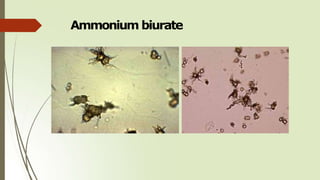 Ammonium biurate
 