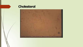Cholesterol
 