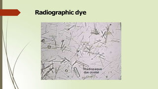 Radiographic dye
 