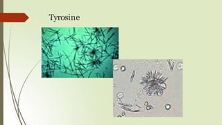 Tyrosine
 