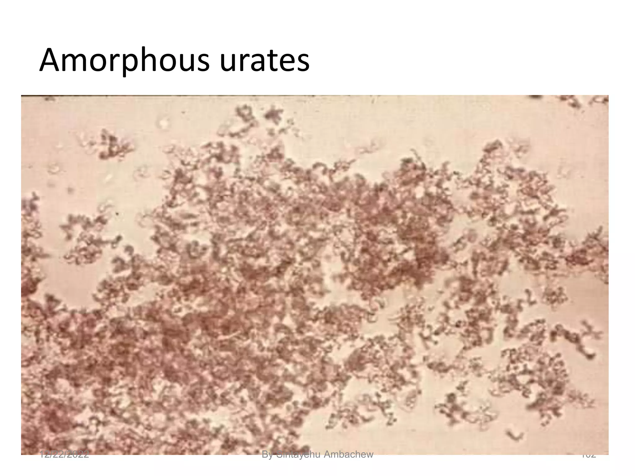 Amorphous urates
102
12/22/2022 By Sintayehu Ambachew
 