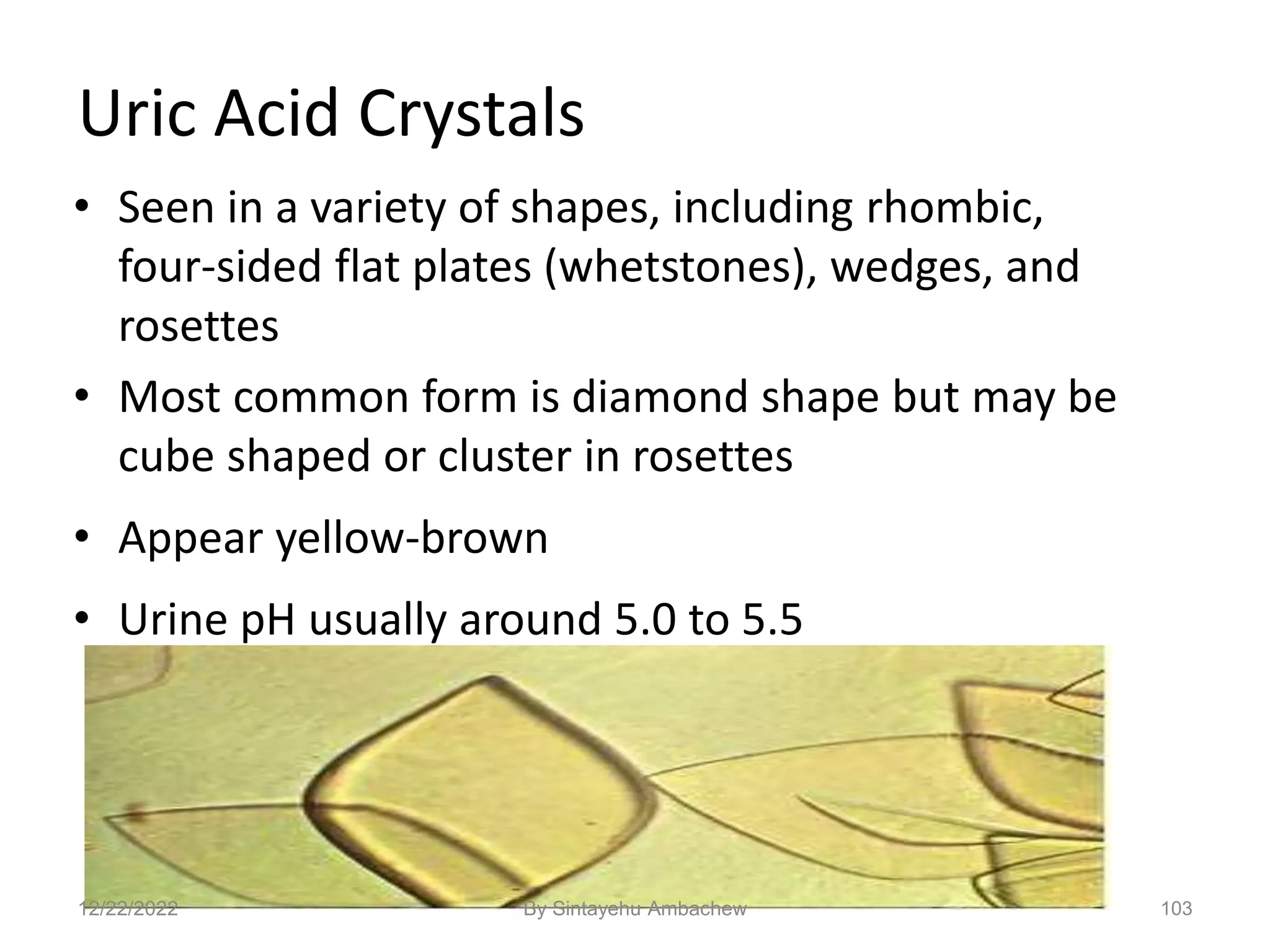 103
Uric Acid Crystals
• Seen in a variety of shapes, including rhombic,
four-sided flat plates (whetstones), wedges, and
rosettes
• Most common form is diamond shape but may be
cube shaped or cluster in rosettes
• Appear yellow-brown
• Urine pH usually around 5.0 to 5.5
12/22/2022 By Sintayehu Ambachew
 
