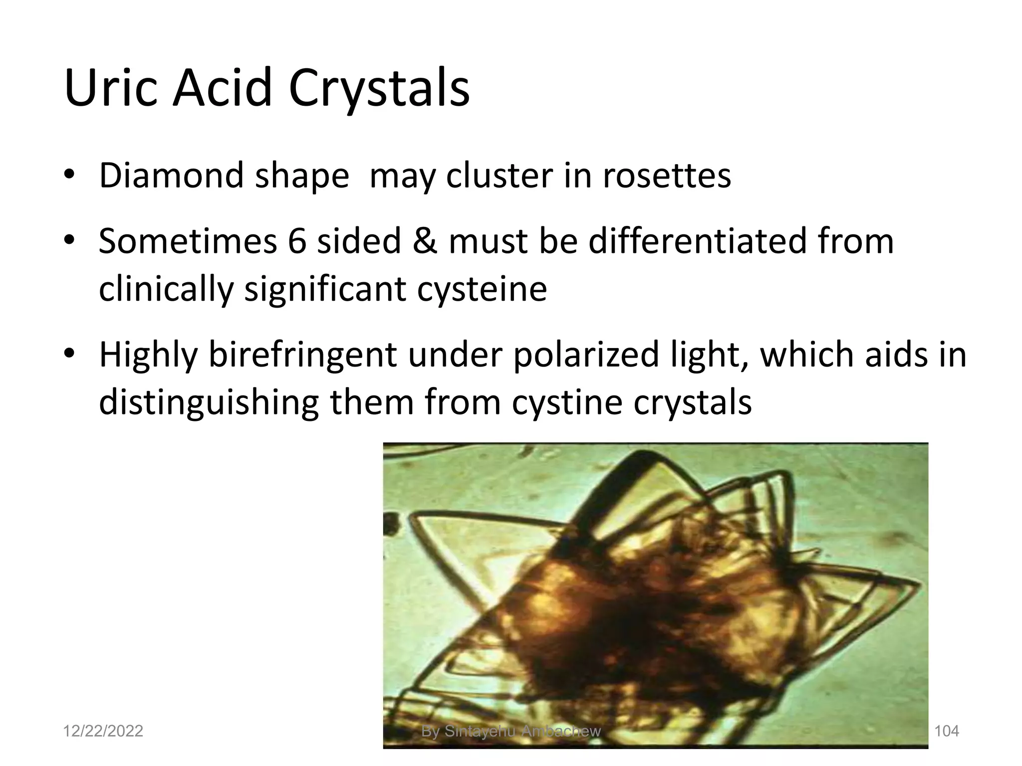 104
Uric Acid Crystals
• Diamond shape may cluster in rosettes
• Sometimes 6 sided & must be differentiated from
clinically significant cysteine
• Highly birefringent under polarized light, which aids in
distinguishing them from cystine crystals
12/22/2022 By Sintayehu Ambachew
 