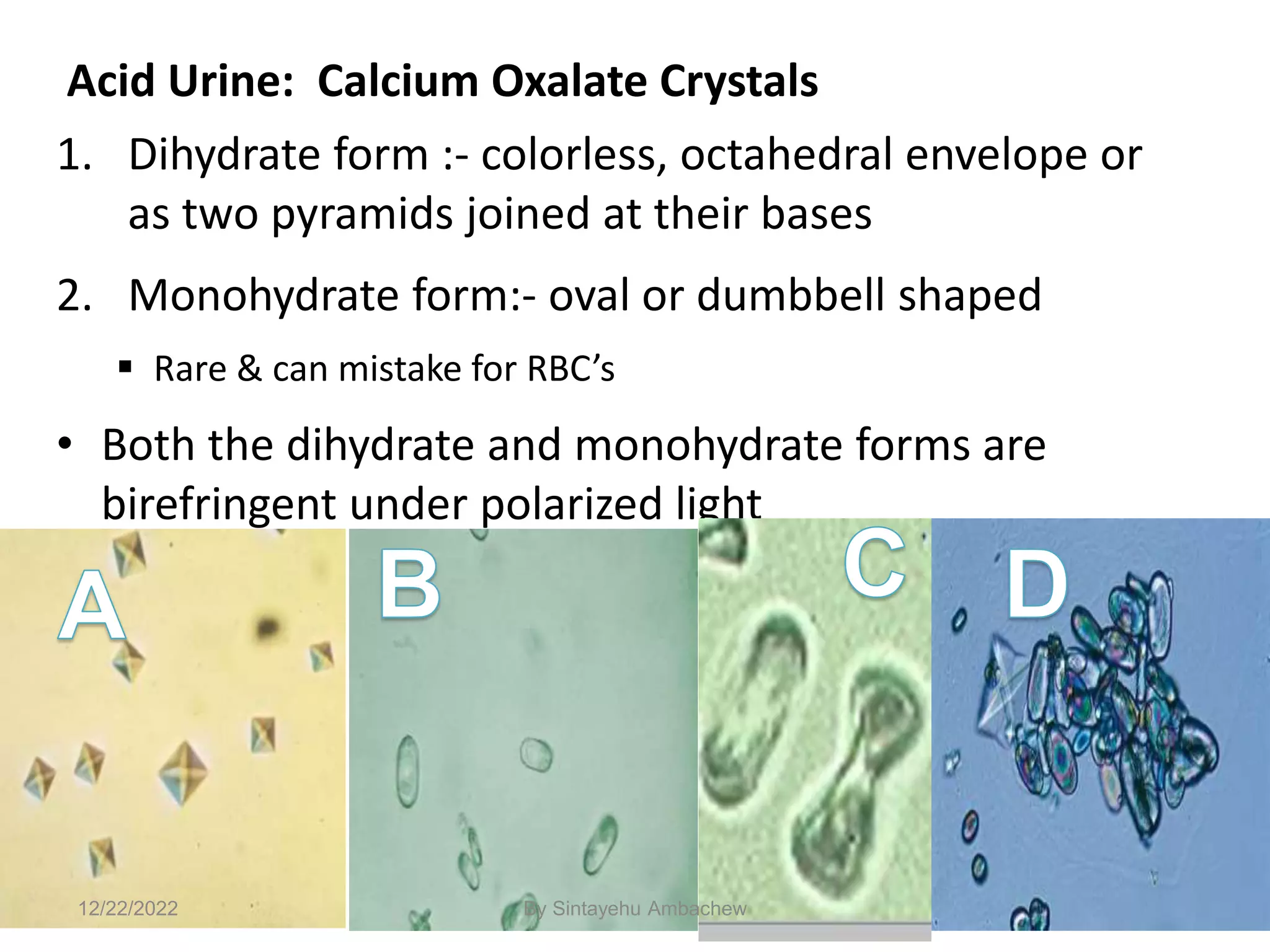 106
Acid Urine: Calcium Oxalate Crystals
1. Dihydrate form :- colorless, octahedral envelope or
as two pyramids joined at their bases
2. Monohydrate form:- oval or dumbbell shaped
 Rare & can mistake for RBC’s
• Both the dihydrate and monohydrate forms are
birefringent under polarized light
12/22/2022 By Sintayehu Ambachew
 