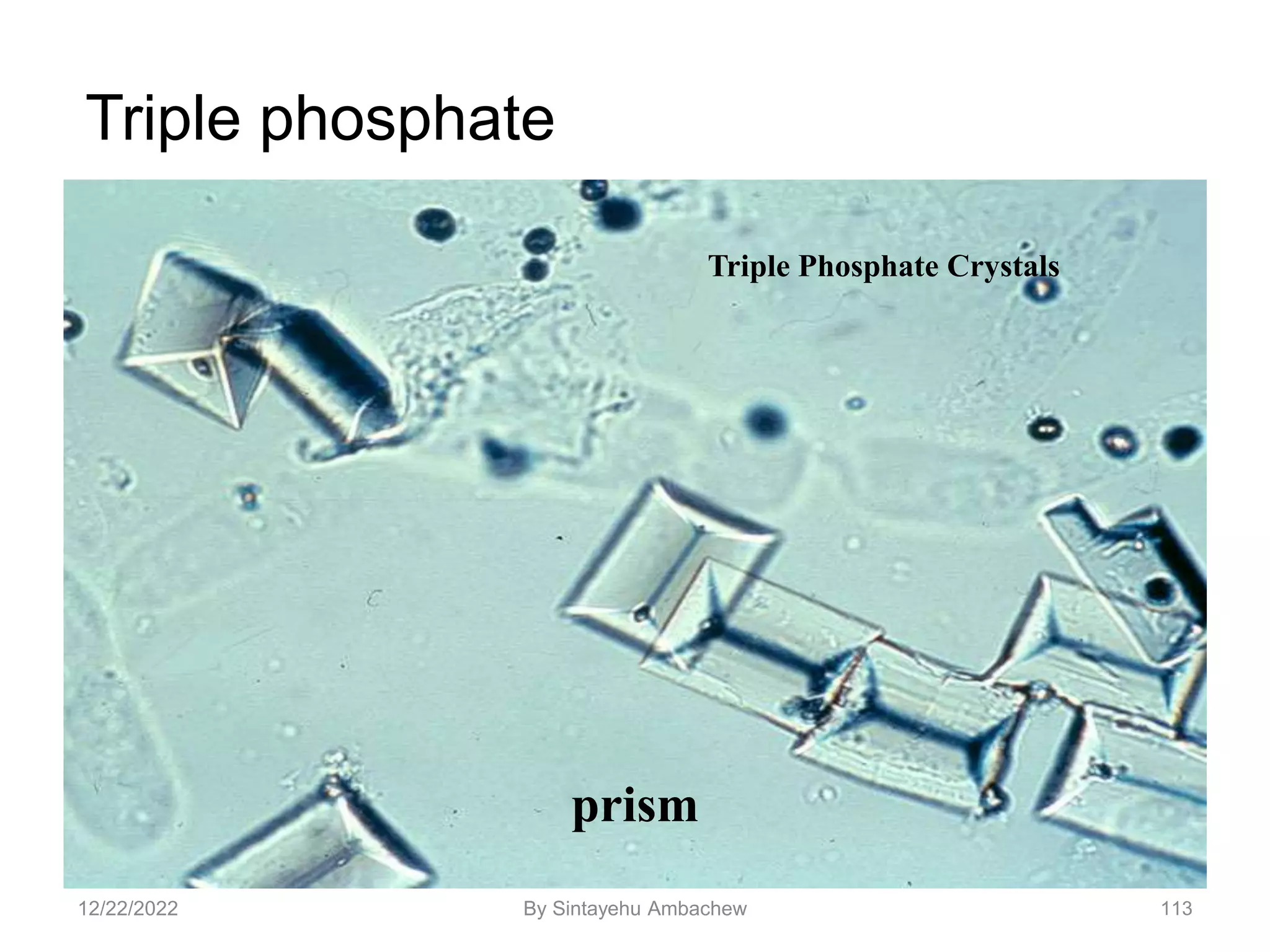 Triple phosphate
Triple Phosphate Crystals
prism
12/22/2022 113
By Sintayehu Ambachew
 