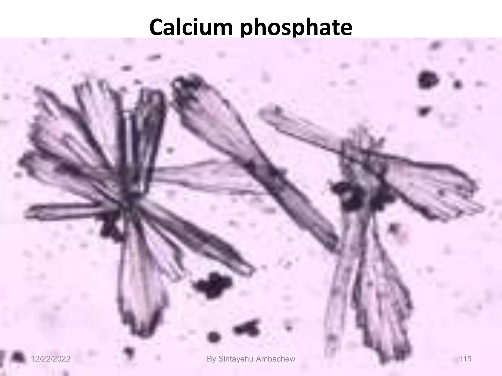 Calcium phosphate
12/22/2022 115
By Sintayehu Ambachew
 