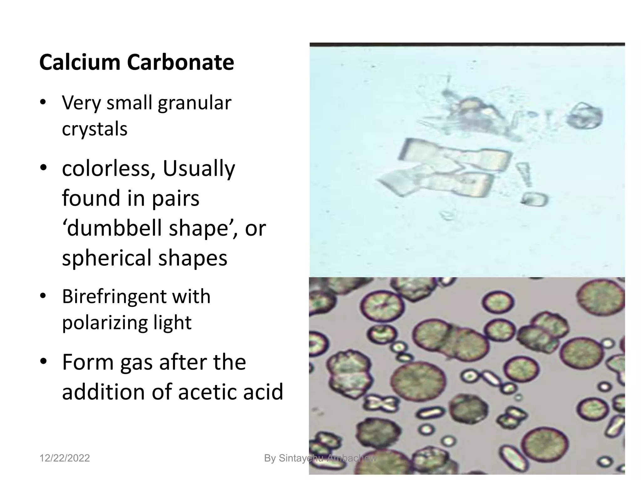 116
Calcium Carbonate
• Very small granular
crystals
• colorless, Usually
found in pairs
‘dumbbell shape’, or
spherical shapes
• Birefringent with
polarizing light
• Form gas after the
addition of acetic acid
12/22/2022 By Sintayehu Ambachew
 
