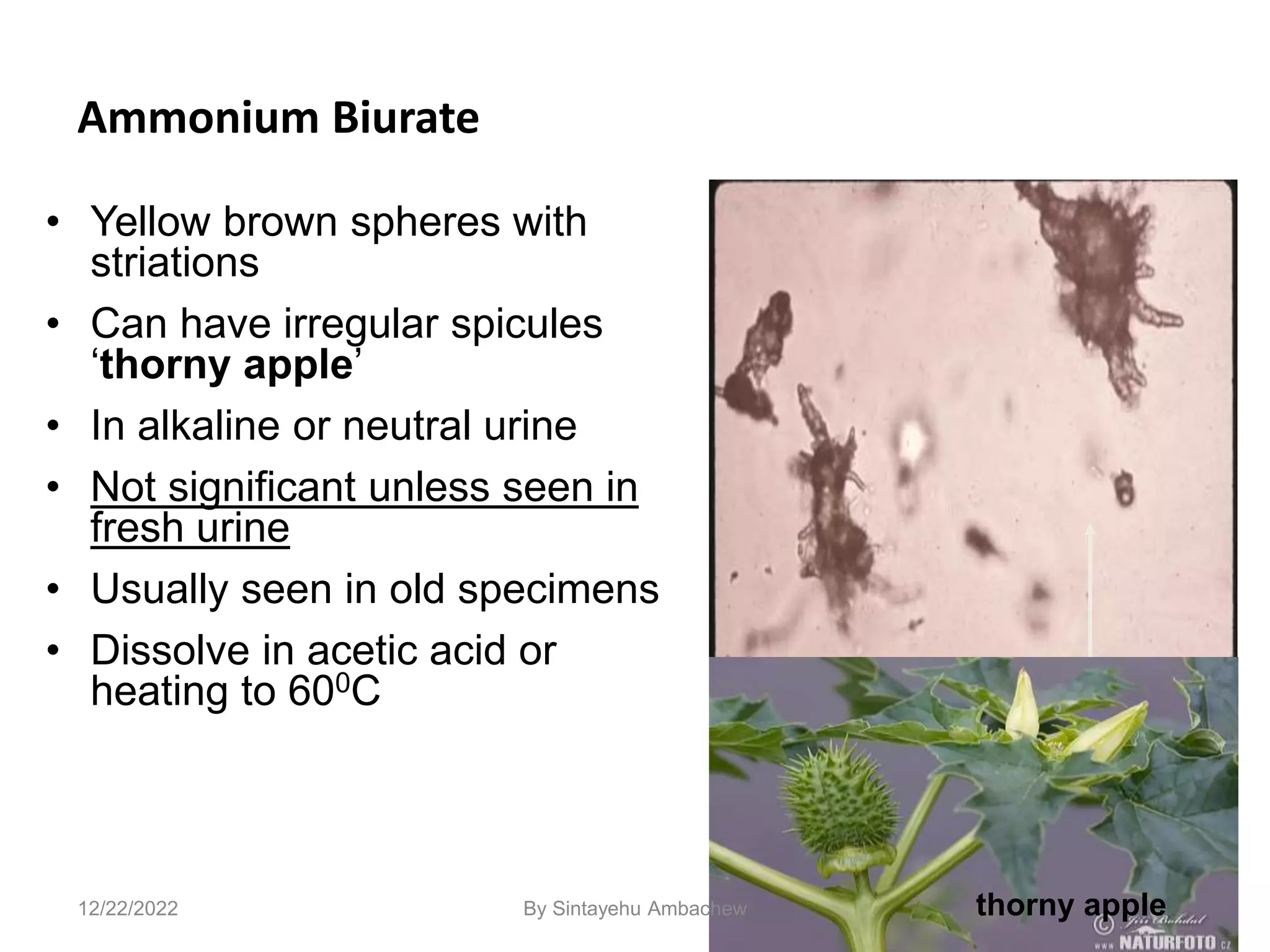 117
Ammonium Biurate
• Yellow brown spheres with
striations
• Can have irregular spicules
‘thorny apple’
• In alkaline or neutral urine
• Not significant unless seen in
fresh urine
• Usually seen in old specimens
• Dissolve in acetic acid or
heating to 600C
12/22/2022 thorny apple
By Sintayehu Ambachew
 