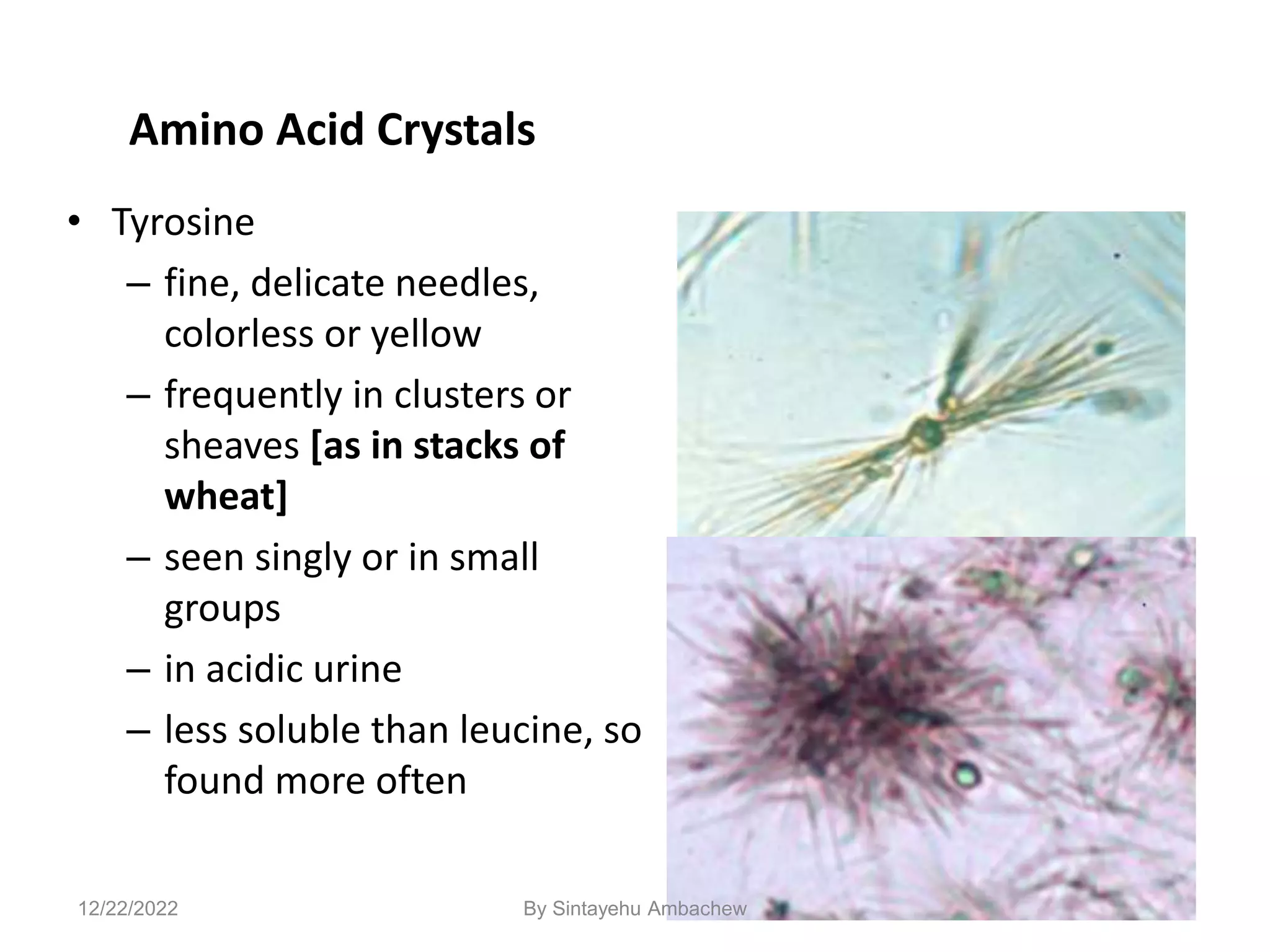122
Amino Acid Crystals
• Tyrosine
– fine, delicate needles,
colorless or yellow
– frequently in clusters or
sheaves [as in stacks of
wheat]
– seen singly or in small
groups
– in acidic urine
– less soluble than leucine, so
found more often
12/22/2022 By Sintayehu Ambachew
 