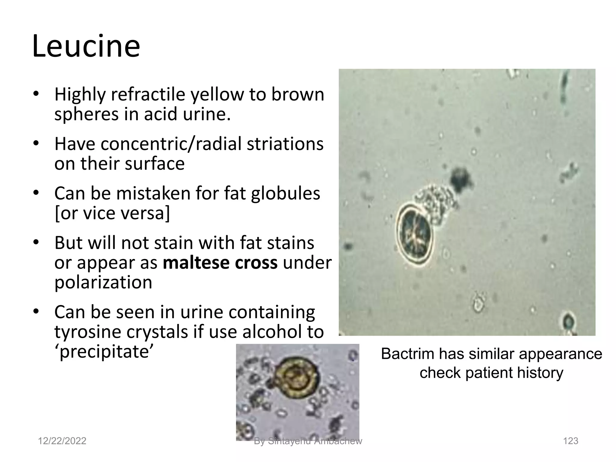 123
Leucine
• Highly refractile yellow to brown
spheres in acid urine.
• Have concentric/radial striations
on their surface
• Can be mistaken for fat globules
[or vice versa]
• But will not stain with fat stains
or appear as maltese cross under
polarization
• Can be seen in urine containing
tyrosine crystals if use alcohol to
‘precipitate’ Bactrim has similar appearance
check patient history
12/22/2022 By Sintayehu Ambachew
 