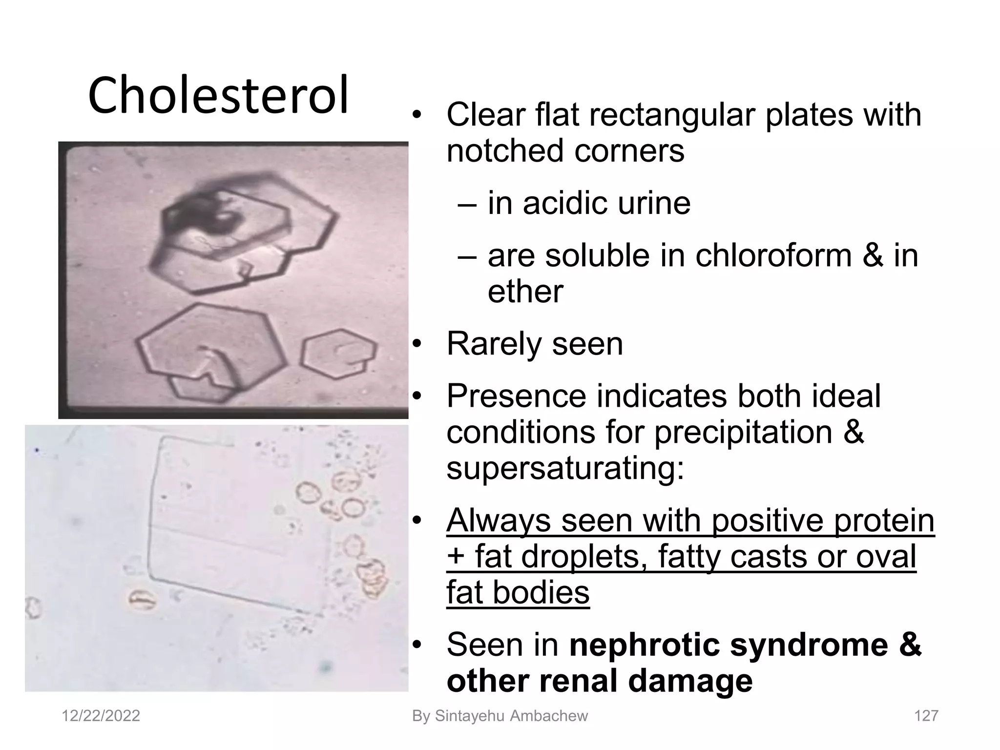 127
Cholesterol • Clear flat rectangular plates with
notched corners
– in acidic urine
– are soluble in chloroform & in
ether
• Rarely seen
• Presence indicates both ideal
conditions for precipitation &
supersaturating:
• Always seen with positive protein
+ fat droplets, fatty casts or oval
fat bodies
• Seen in nephrotic syndrome &
other renal damage
12/22/2022 By Sintayehu Ambachew
 