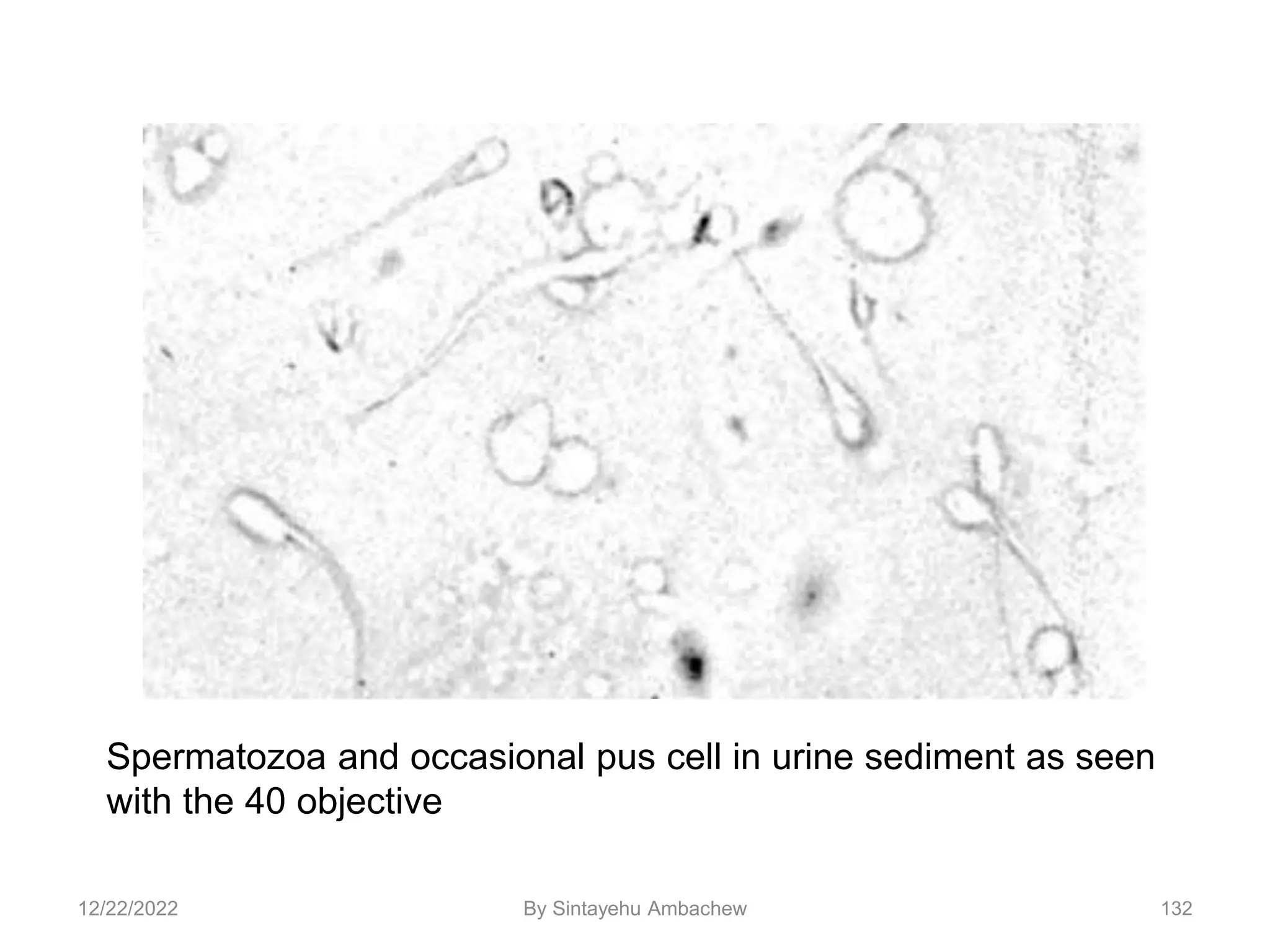 132
Spermatozoa and occasional pus cell in urine sediment as seen
with the 40 objective
12/22/2022 By Sintayehu Ambachew
 