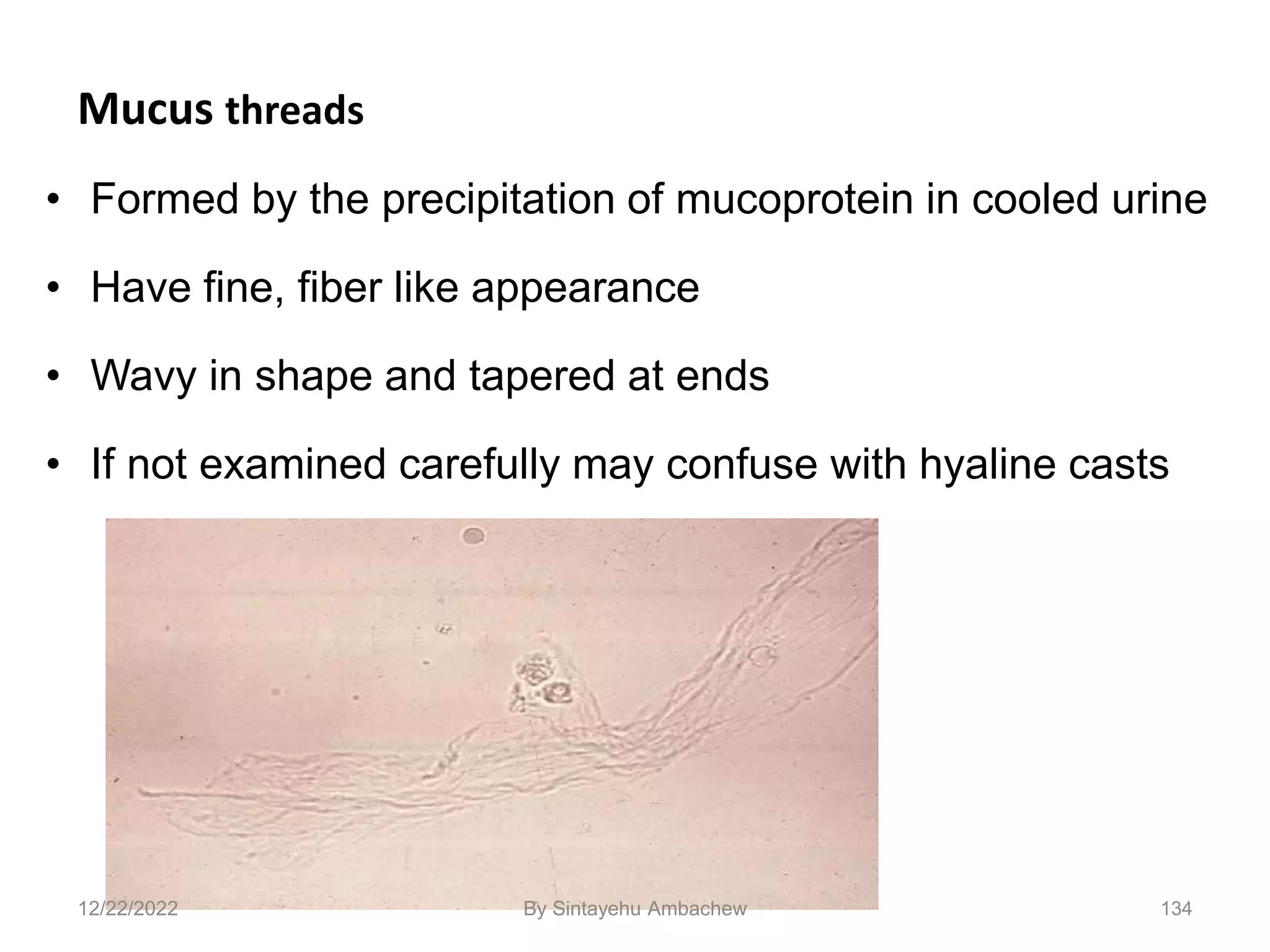 Mucus threads
• Formed by the precipitation of mucoprotein in cooled urine
• Have fine, fiber like appearance
• Wavy in shape and tapered at ends
• If not examined carefully may confuse with hyaline casts
134
12/22/2022 By Sintayehu Ambachew
 