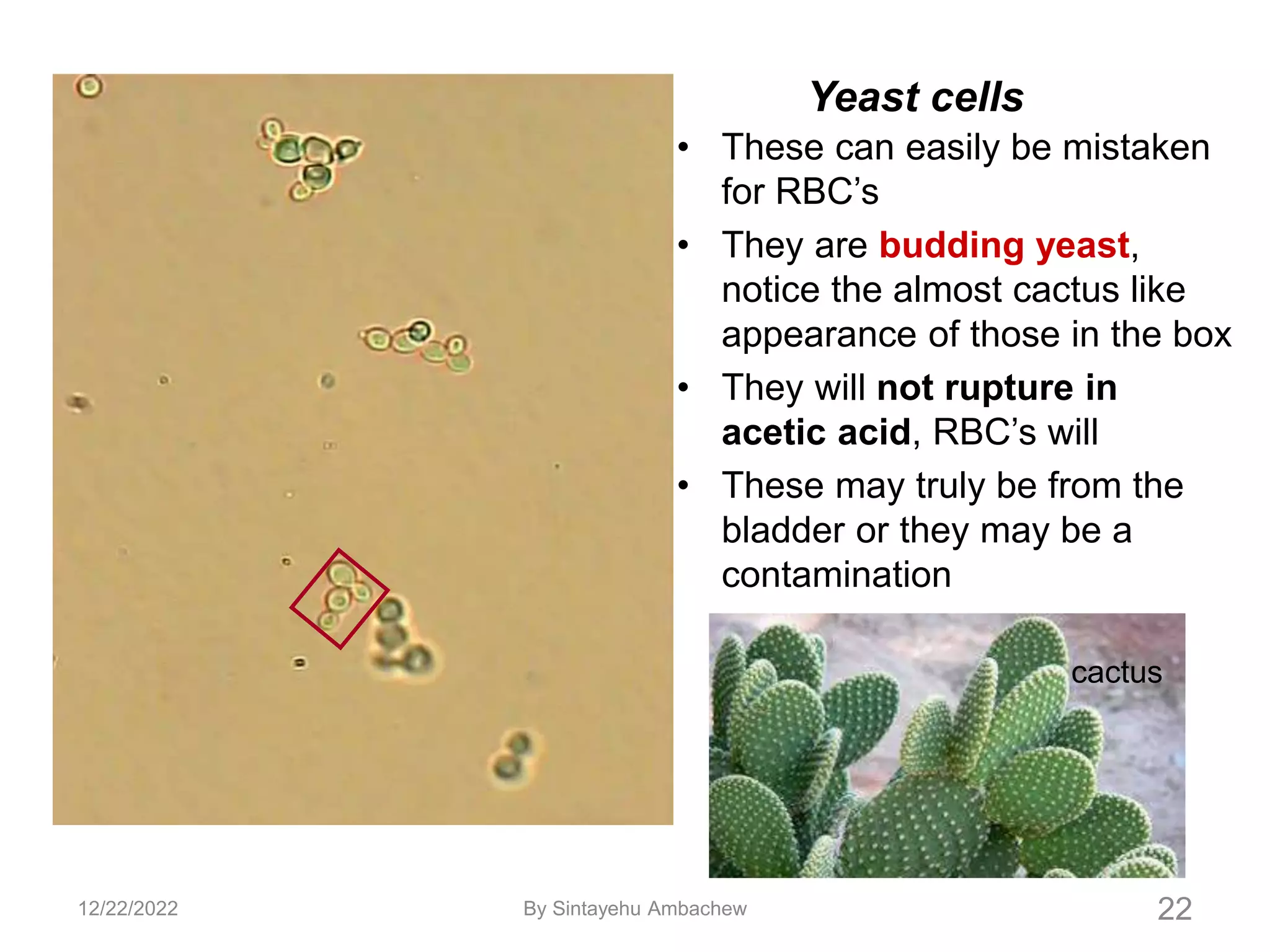 22
• These can easily be mistaken
for RBC’s
• They are budding yeast,
notice the almost cactus like
appearance of those in the box
• They will not rupture in
acetic acid, RBC’s will
• These may truly be from the
bladder or they may be a
contamination
Yeast cells
cactus
12/22/2022 By Sintayehu Ambachew
 