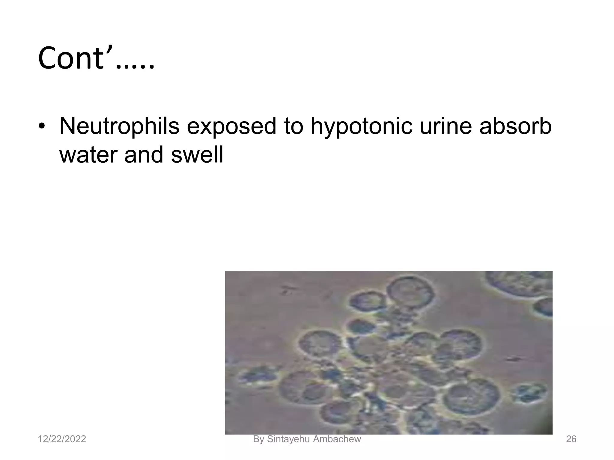 Cont’…..
• Neutrophils exposed to hypotonic urine absorb
water and swell
26
12/22/2022 By Sintayehu Ambachew
 
