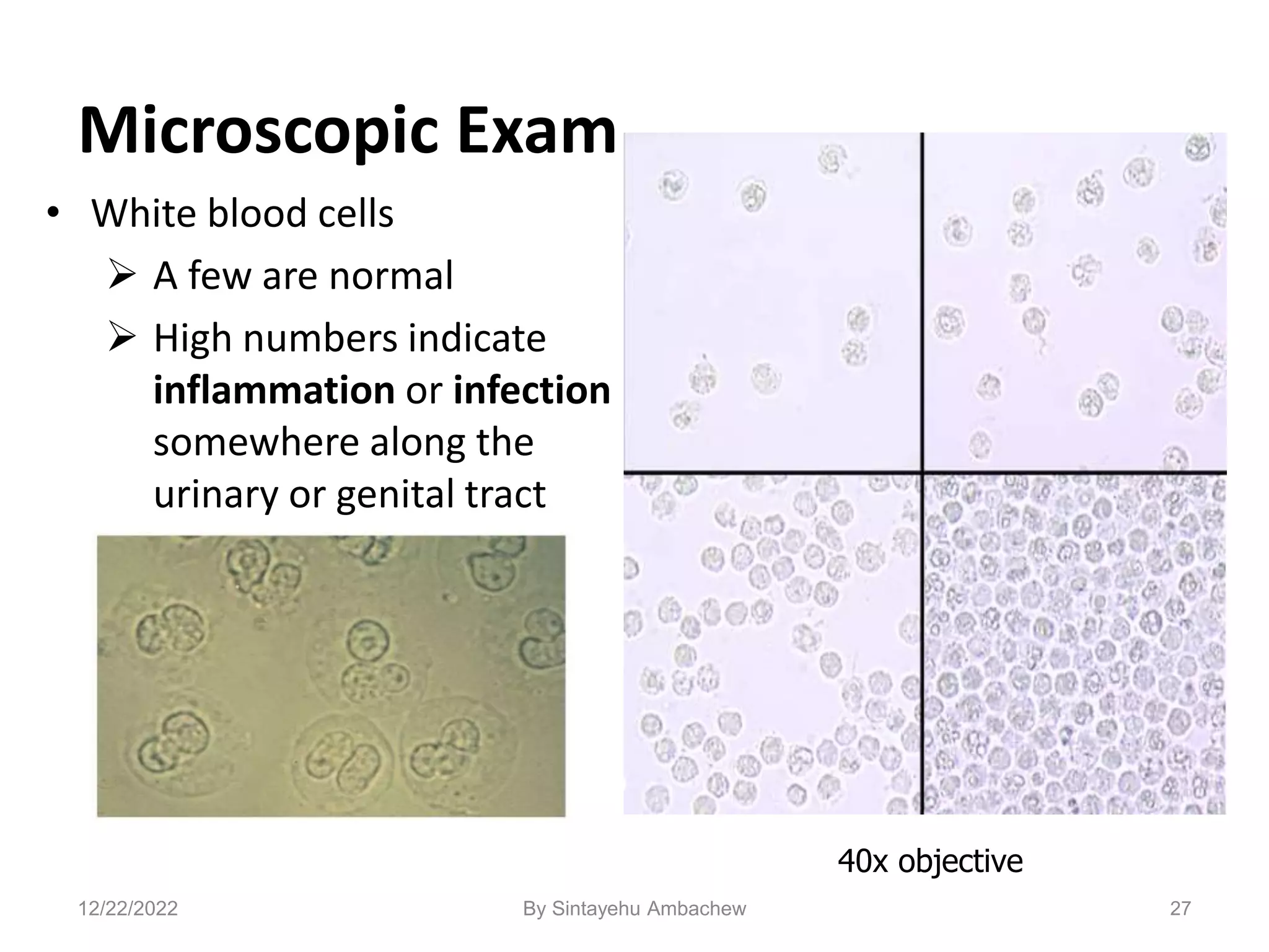 Microscopic Exam
• White blood cells
 A few are normal
 High numbers indicate
inflammation or infection
somewhere along the
urinary or genital tract
27
40x objective
12/22/2022 By Sintayehu Ambachew
 