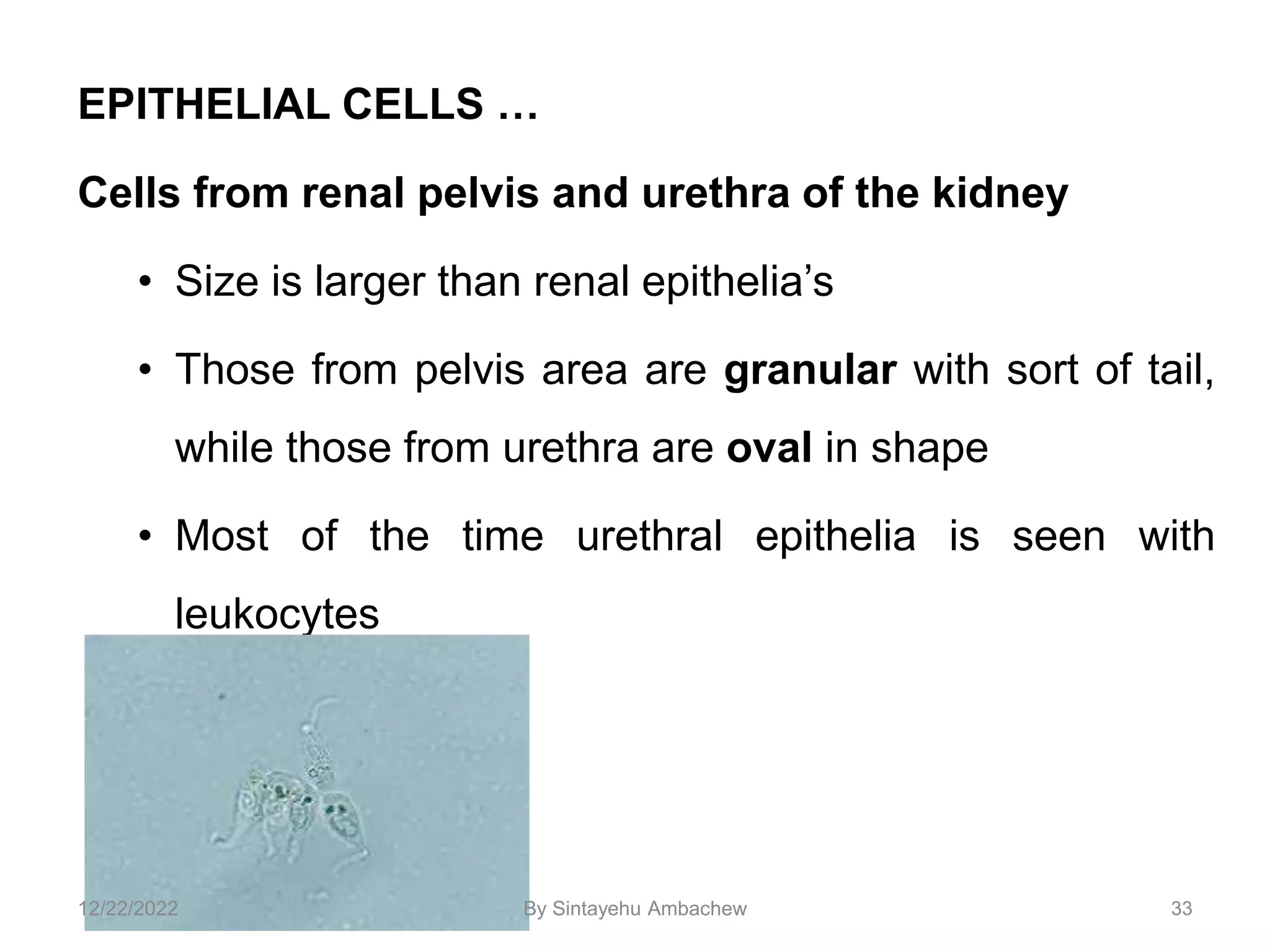 EPITHELIAL CELLS …
Cells from renal pelvis and urethra of the kidney
• Size is larger than renal epithelia’s
• Those from pelvis area are granular with sort of tail,
while those from urethra are oval in shape
• Most of the time urethral epithelia is seen with
leukocytes
33
12/22/2022 By Sintayehu Ambachew
 