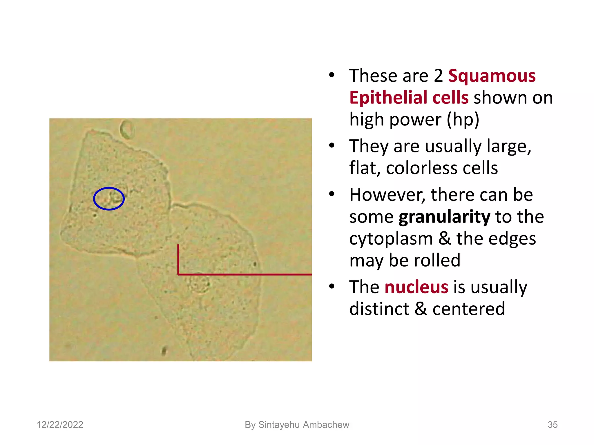 35
• These are 2 Squamous
Epithelial cells shown on
high power (hp)
• They are usually large,
flat, colorless cells
• However, there can be
some granularity to the
cytoplasm & the edges
may be rolled
• The nucleus is usually
distinct & centered
12/22/2022 By Sintayehu Ambachew
 