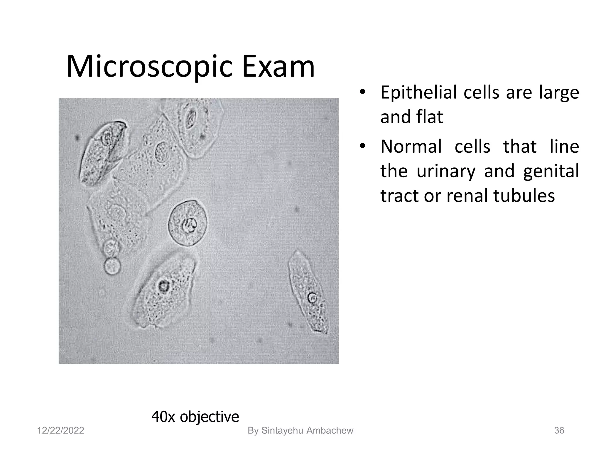 Microscopic Exam
• Epithelial cells are large
and flat
• Normal cells that line
the urinary and genital
tract or renal tubules
36
40x objective
12/22/2022 By Sintayehu Ambachew
 
