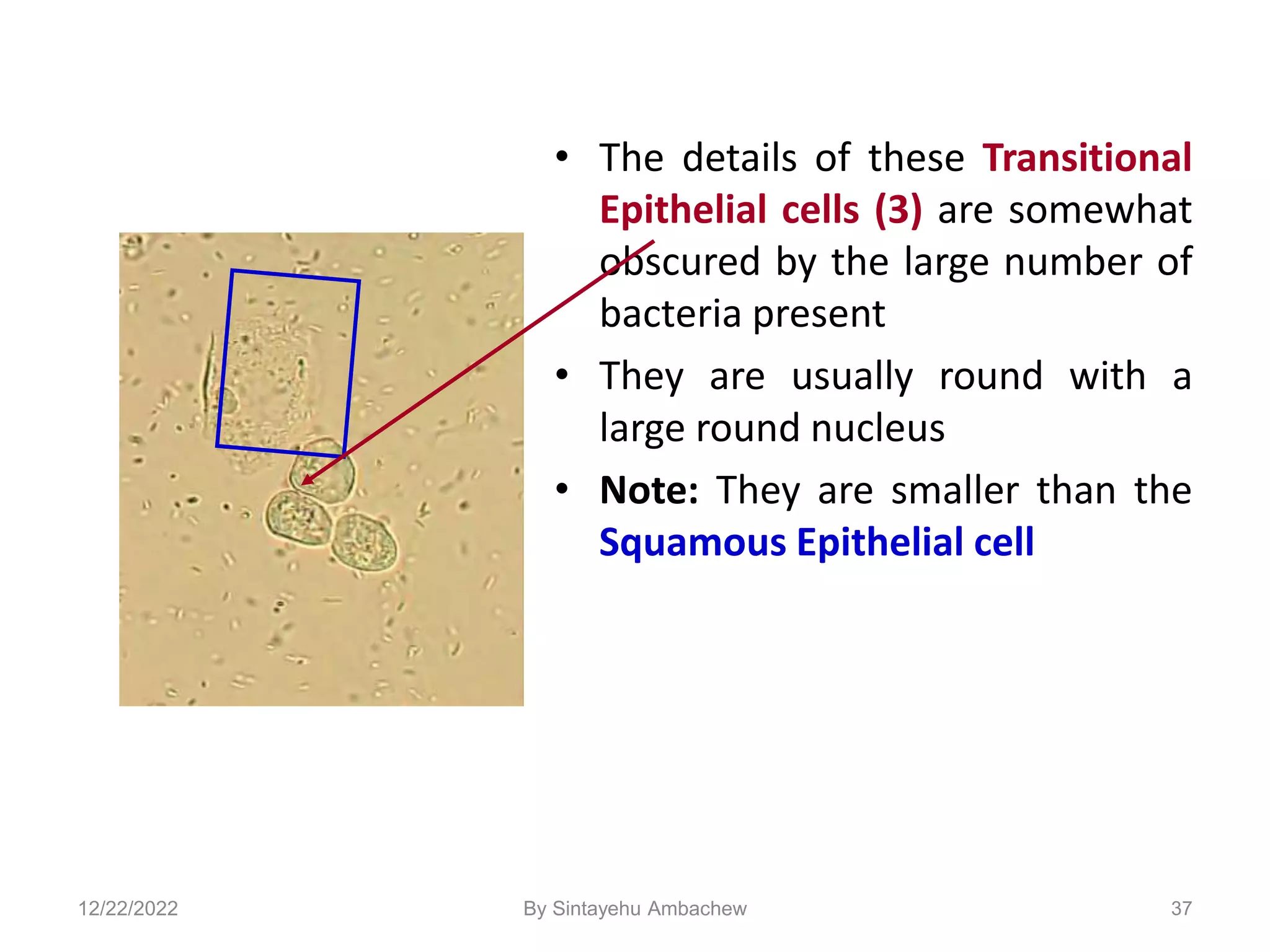 37
• The details of these Transitional
Epithelial cells (3) are somewhat
obscured by the large number of
bacteria present
• They are usually round with a
large round nucleus
• Note: They are smaller than the
Squamous Epithelial cell
12/22/2022 By Sintayehu Ambachew
 