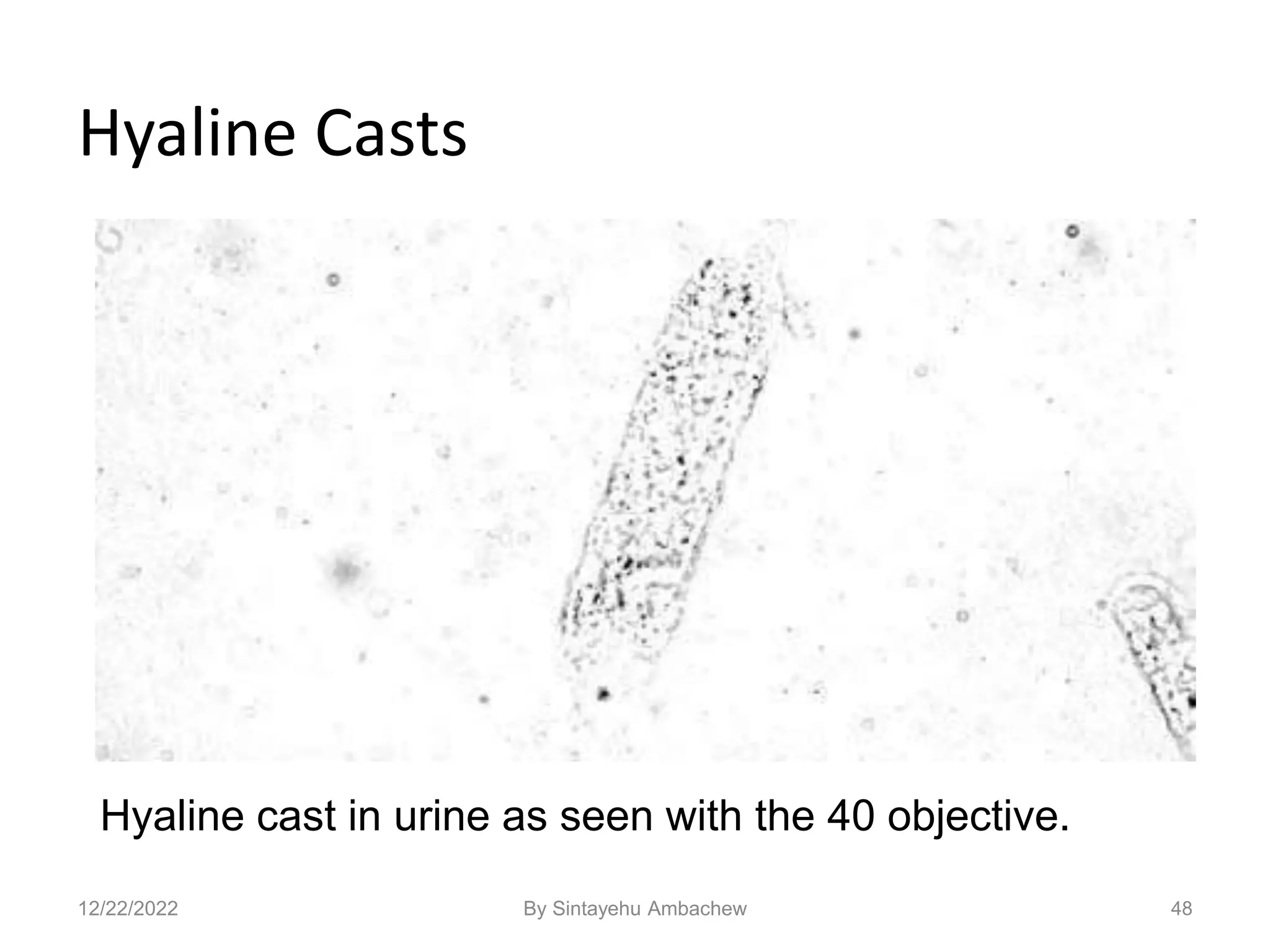 Hyaline Casts
48
Hyaline cast in urine as seen with the 40 objective.
12/22/2022 By Sintayehu Ambachew
 