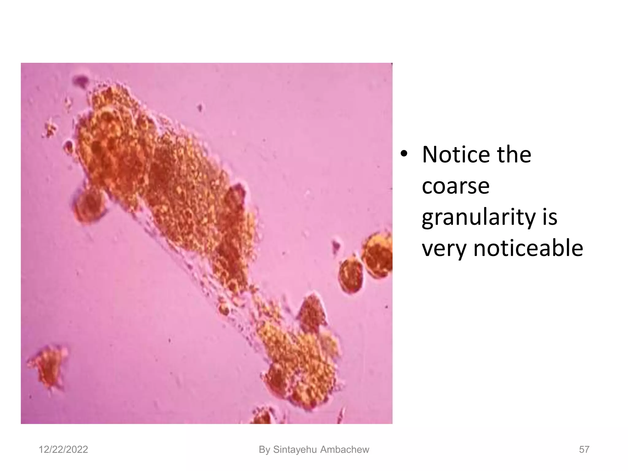 • Notice the
coarse
granularity is
very noticeable
57
12/22/2022 By Sintayehu Ambachew
 