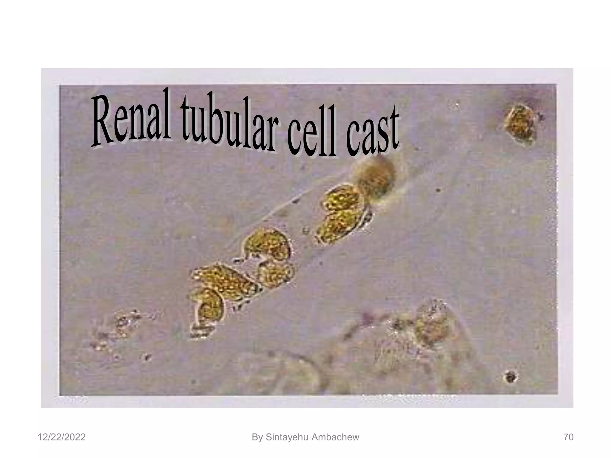 70
12/22/2022 By Sintayehu Ambachew
 