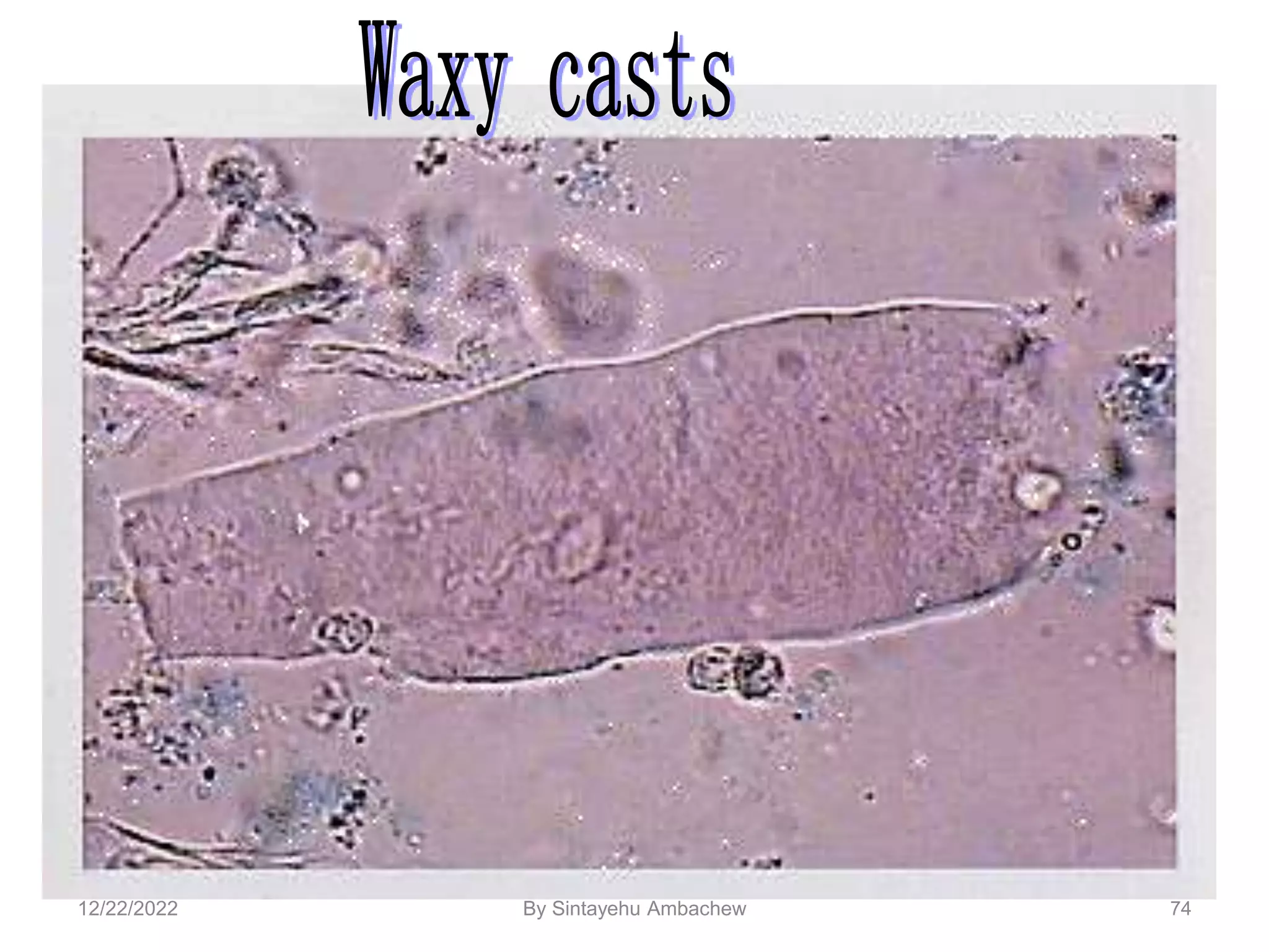 74
12/22/2022 By Sintayehu Ambachew
 
