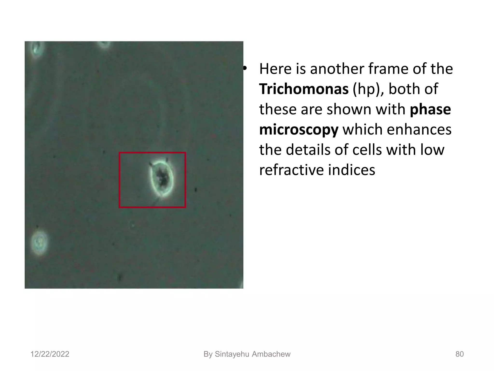 80
• Here is another frame of the
Trichomonas (hp), both of
these are shown with phase
microscopy which enhances
the details of cells with low
refractive indices
12/22/2022 By Sintayehu Ambachew
 