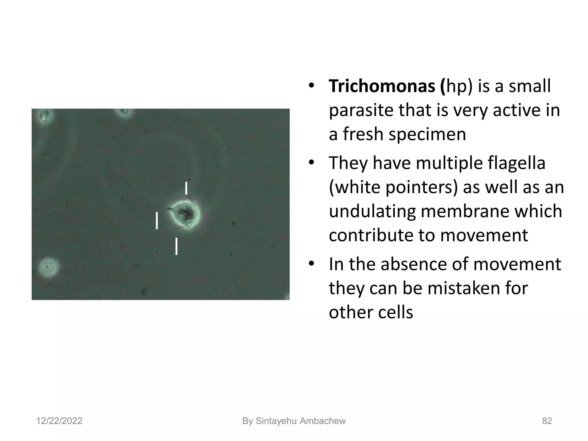 82
• Trichomonas (hp) is a small
parasite that is very active in
a fresh specimen
• They have multiple flagella
(white pointers) as well as an
undulating membrane which
contribute to movement
• In the absence of movement
they can be mistaken for
other cells
12/22/2022 By Sintayehu Ambachew
 