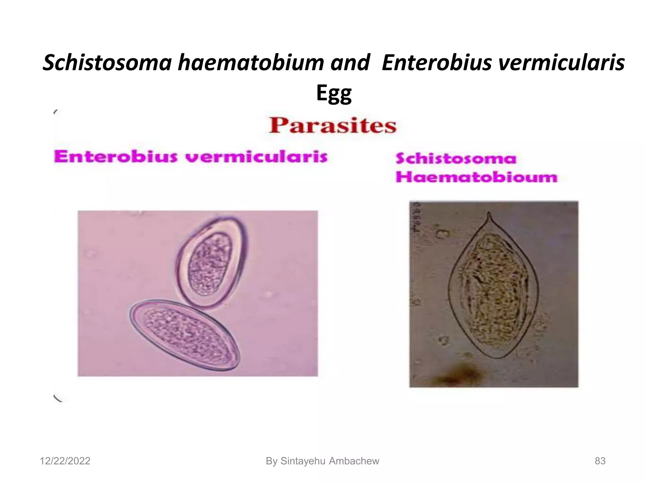 83
Schistosoma haematobium and Enterobius vermicularis
Egg
12/22/2022 By Sintayehu Ambachew
 