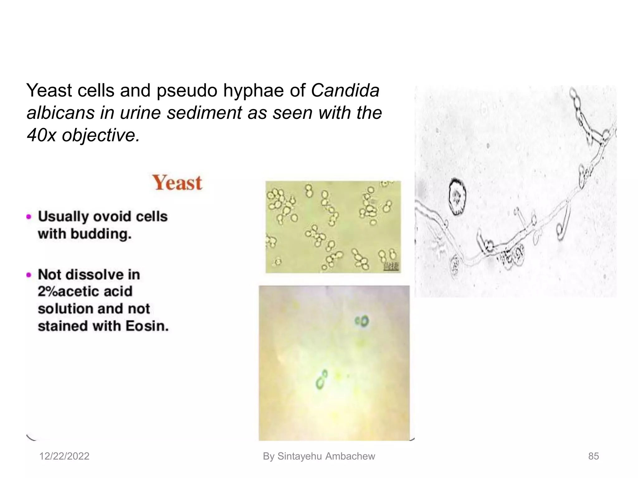 85
Yeast cells and pseudo hyphae of Candida
albicans in urine sediment as seen with the
40x objective.
12/22/2022 By Sintayehu Ambachew
 