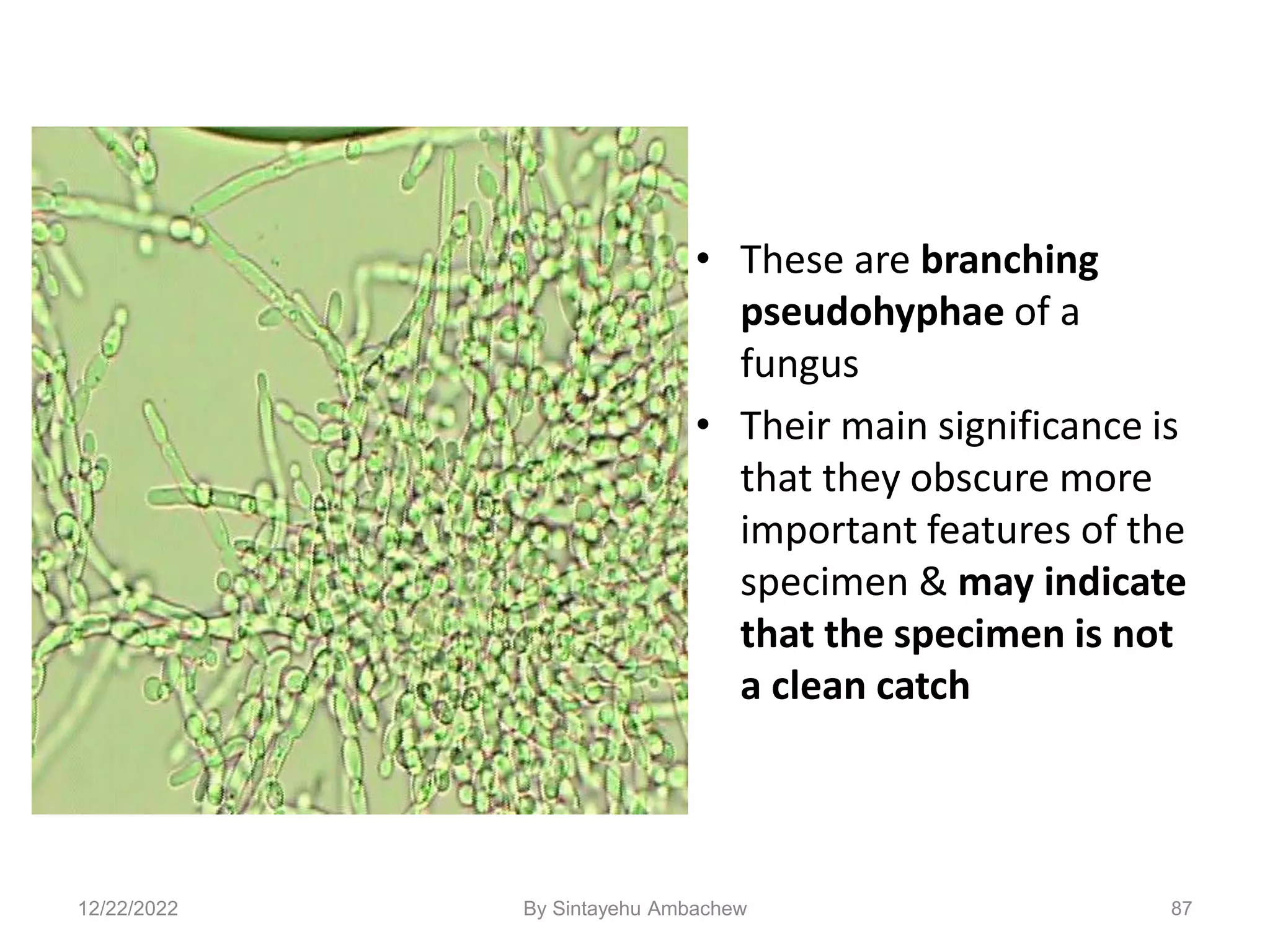 87
• These are branching
pseudohyphae of a
fungus
• Their main significance is
that they obscure more
important features of the
specimen & may indicate
that the specimen is not
a clean catch
12/22/2022 By Sintayehu Ambachew
 