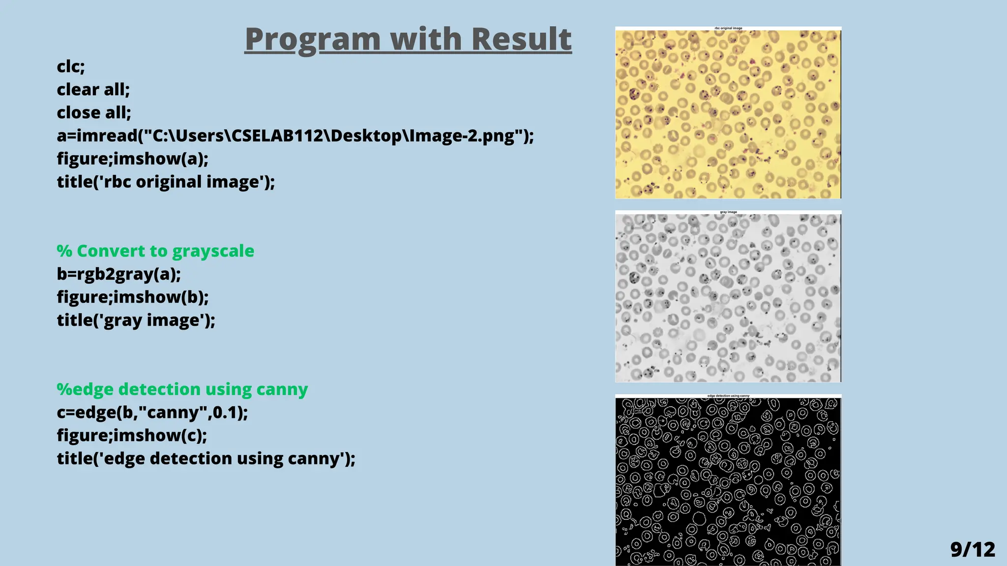 Microscopic Image Analysis for Cell Counting using MATLAB.pdf