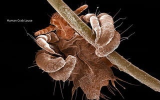 Human Crab Louse
 