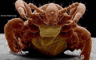 Human Head Louse
 