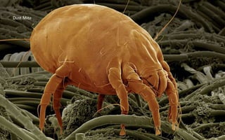 Dust Mite
 