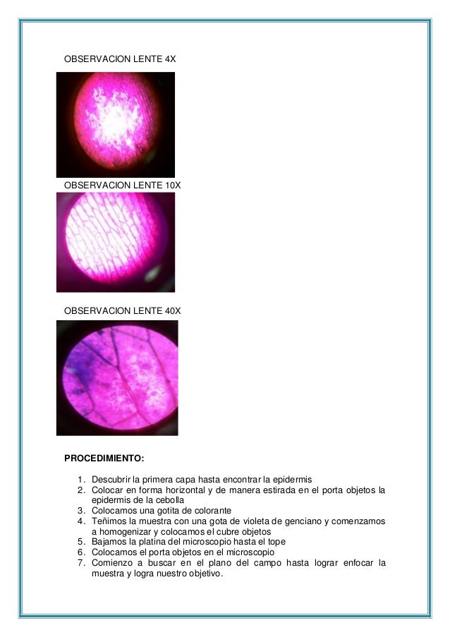 microscopio-cebolla