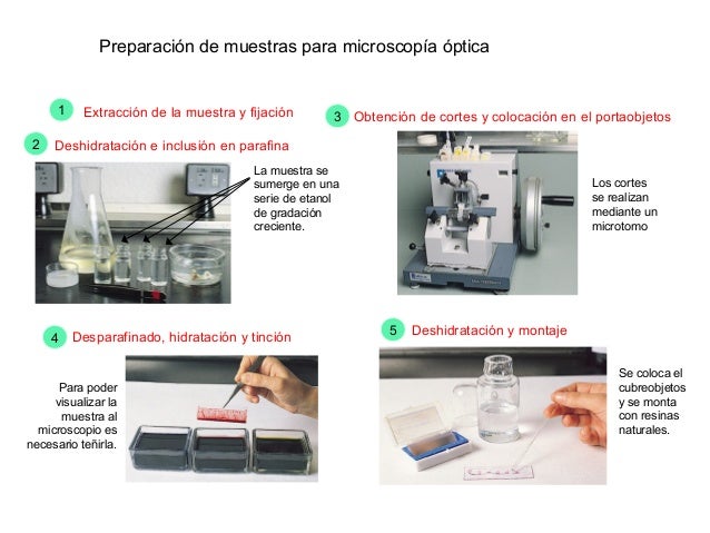 Microscopios