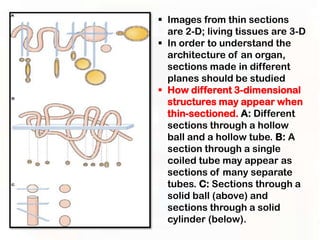  Images from thin sections
  are 2-D; living tissues are 3-D
 In order to understand the
  architecture of an organ,
  sections made in different
  planes should be studied
 How different 3-dimensional
  structures may appear when
  thin-sectioned. A: Different
  sections through a hollow
  ball and a hollow tube. B: A
  section through a single
  coiled tube may appear as
  sections of many separate
  tubes. C: Sections through a
  solid ball (above) and
  sections through a solid
  cylinder (below).
 