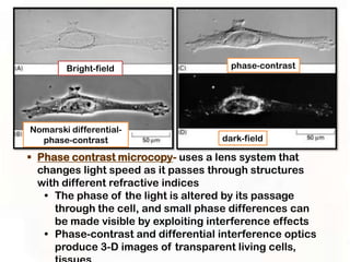 Bright-field                   phase-contrast




Nomarski differential-
  phase-contrast                     dark-field

 Phase contrast microcopy- uses a lens system that
  changes light speed as it passes through structures
  with different refractive indices
   • The phase of the light is altered by its passage
     through the cell, and small phase differences can
     be made visible by exploiting interference effects
   • Phase-contrast and differential interference optics
     produce 3-D images of transparent living cells,
 