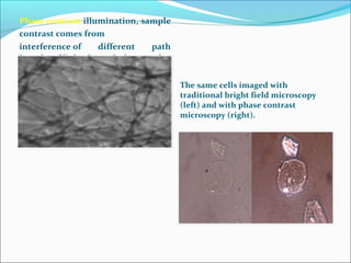 Phase contrast illumination, sample
contrast comes from
interference of different path
lengths of light through the sample.
The same cells imaged with
traditional bright field microscopy
(left) and with phase contrast
microscopy (right).
 