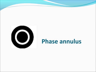 Phase annulus
 