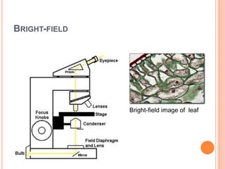 BRIGHT-FIELD
Bright-field image of leaf
 