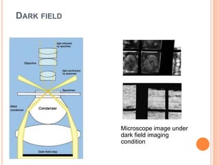 DARK FIELD
Microscope image under
dark field imaging
condition
 