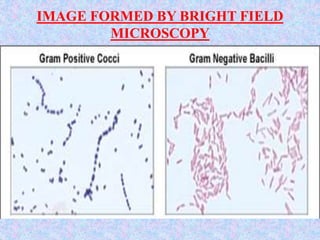 IMAGE FORMED BY BRIGHT FIELD
MICROSCOPY
(unstained)
 