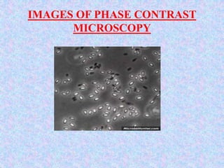 IMAGES OF PHASE CONTRAST
MICROSCOPY
 